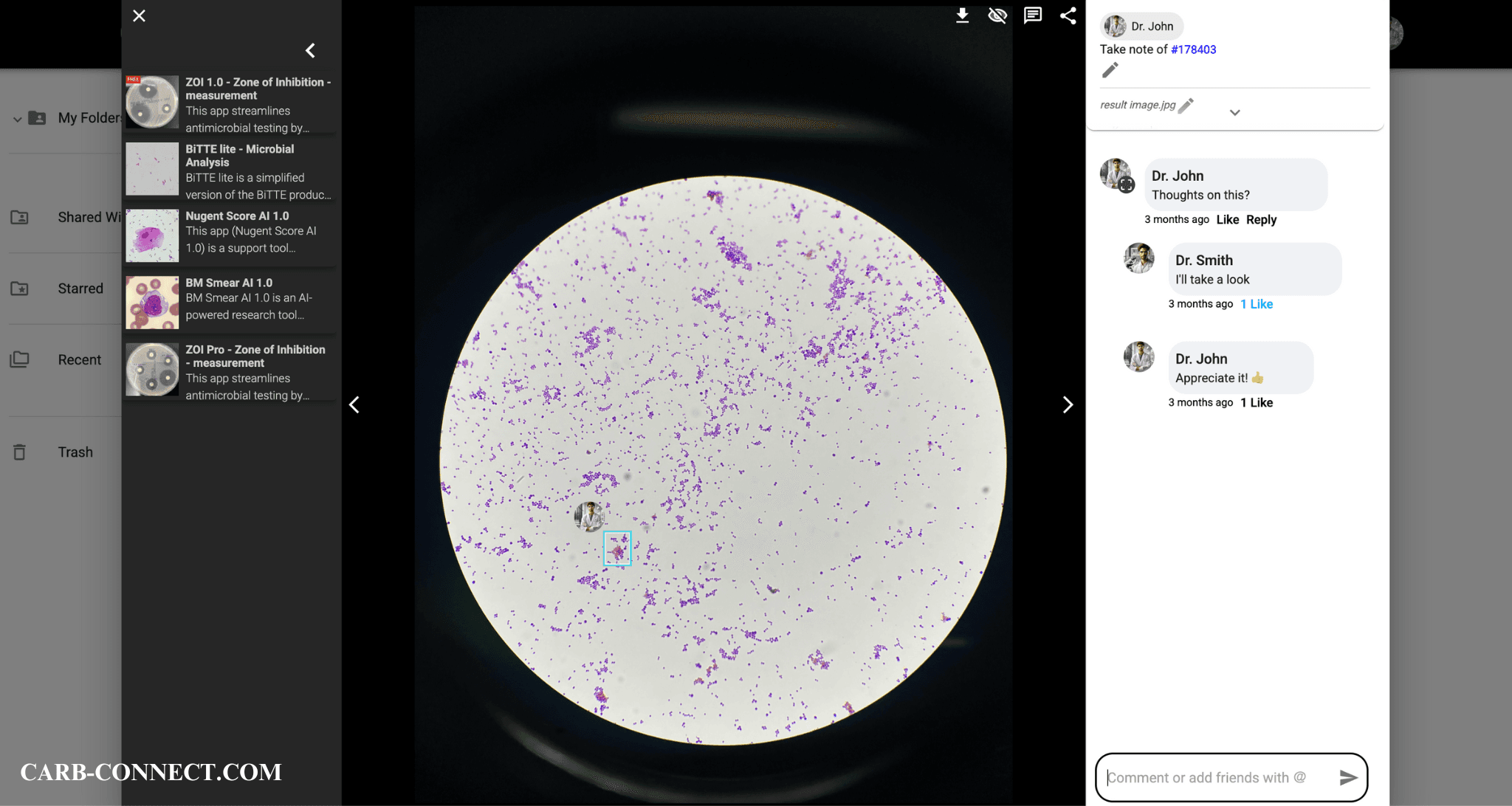 Screenshot of communication in CarbConnect